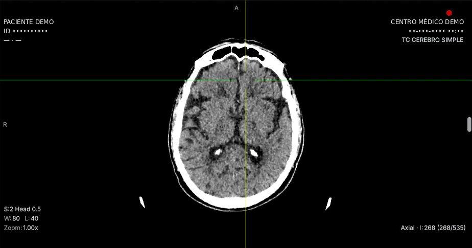 Multiplanar reconstruction · Axial