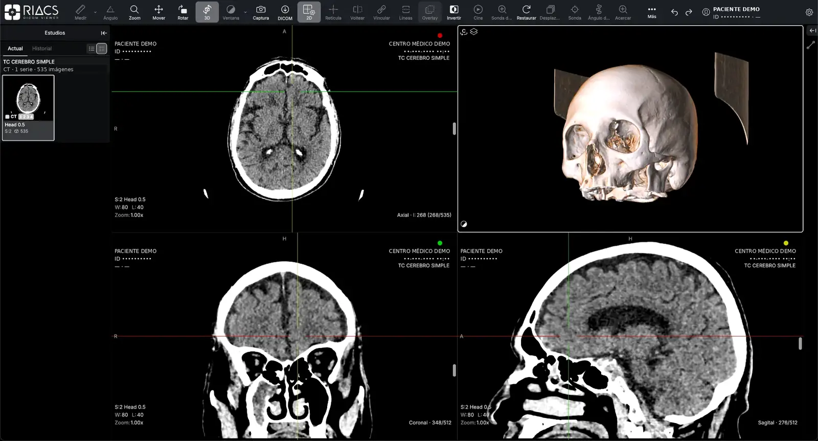 RIACS Viewer · Actual screenshot with demo data. AI highlights are illustrative, not diagnostic results.